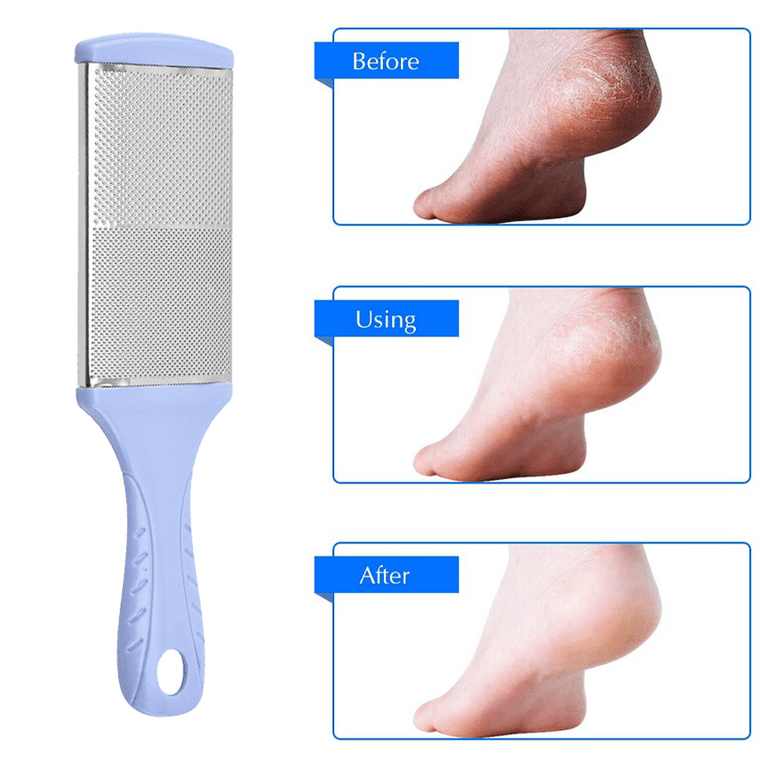 Pedicure Knife Foot Sharpeners, Foot File Callus Remover, Remove Hard Skin  for Wet and Dry Feet,Foot Scrub Supplies - C type large 