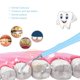 thumbnail image 1 of Limpiador de dientes portátil con pico de agua, 3 colores, escalador dental eléctrico USB, placa de vibración, eliminación de sarro, cuidado de los dientes para el hogar y los viajes(Azul) Ecomeon  no, 1 of 6