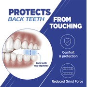 SmartGuard Dental Guard - Protects against nighttime teeth grinding and clenching.