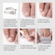 thumbnail image 5 of Vogacara Juego de 3 piezas de Corrector de uñas de acero inoxidable, herramienta para el cuidado de los pies, herramienta para recuperar el cuidado de Suministros de ortodoncia Vogacara CE001666-00, 5 of 8