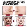 thumbnail image 4 of Suero exfoliante para principiantes con AHAs, ácido láctico, glicólico y salicílico (30 ml), 4 of 4