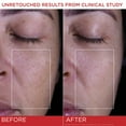 thumbnail image 5 of L'Oreal Paris Revitalift Triple Power Face and Neck Moisturizer, Anti Aging Face Cream with Broad Spectrum SPF 30, Pro-Retinol, Hyaluronic Acid and Vitamin C, 1.7oz, 5 of 8