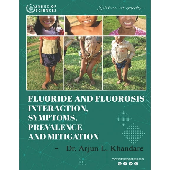 Fluoride And Fluorosis Interaction, Symptoms, Prevalence And Mitigation, (Paperback)