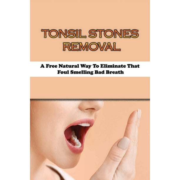 Tonsil Stones Removal A Free Natural Way To Eliminate That Foul