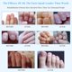thumbnail image 3 of Esencia para el cuidado de las uñas Esencia herbácea para las uñas Eliminación de hongos 4 piezas Esencia natural para el cuidado de las uñas Pluma Anti hongos Tratamiento ANGGREK  Otros, 3 of 8