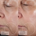 thumbnail image 4 of Skin 2.0 Parches debajo de los ojos con ácido hialurónico y colágeno - Hidratante probado por dermatólogos reduce las bolsas y arrugas - Belleza limpia antienvejecimiento Cuidado de la piel coreano si, 4 of 5