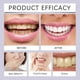 thumbnail image 4 of Teeth Whitening Strips, Safe And Rapid Teeth Whitening Strips, Sensitive Teeth Whitening Strips--3packs, 4 of 5