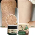 thumbnail image 2 of Crema reparadora de piel de pollo, queratosis, folículo Pilaris, manchas oscuras del cuerpo, elimina los poros gruesos, hidratante, loción de esencia suave, 2 of 5