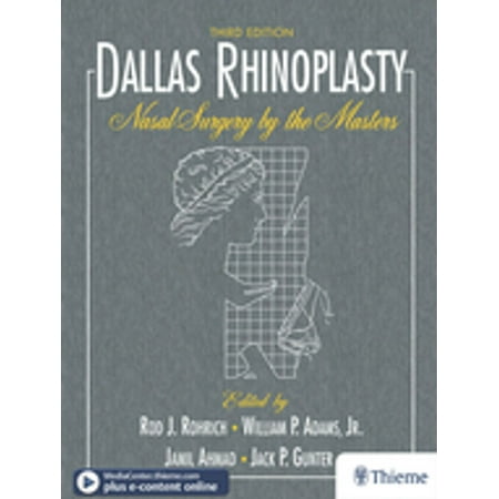 Dallas Rhinoplasty - eBook (Best Rhinoplasty Surgeon In Dallas)