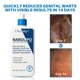 thumbnail image 2 of Crema calmante NanoLipo Eraser para hombre dooeka 3 x 50 ml, 2 of 7
