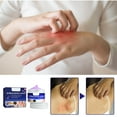 thumbnail image 1 of Xihbxyly oferta de hoy Crema calmante antipruriginosa, 1 of 7