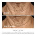thumbnail image 3 of Crema Epionce Intensiva Nutritiva Antienvejecimiento para Piel Seca, 50 ml, 3 of 9