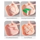thumbnail image 2 of Caja de almacenamiento Inteprter para dentición postiza y Protector bucal color Blanco, 2 of 6