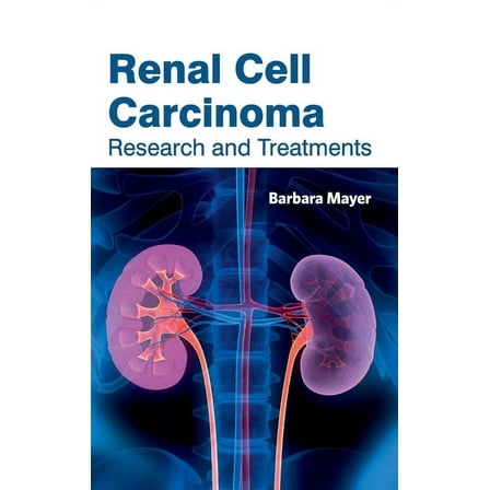 Renal Cell Carcinoma: Research and Treatments, (Hardcover)