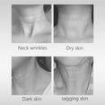 thumbnail image 3 of Eliminación de dispositivos de belleza para el cuello Terapia de doble mentón Lifting facial Vibr Abanopi Herramienta de relajación, 3 of 7