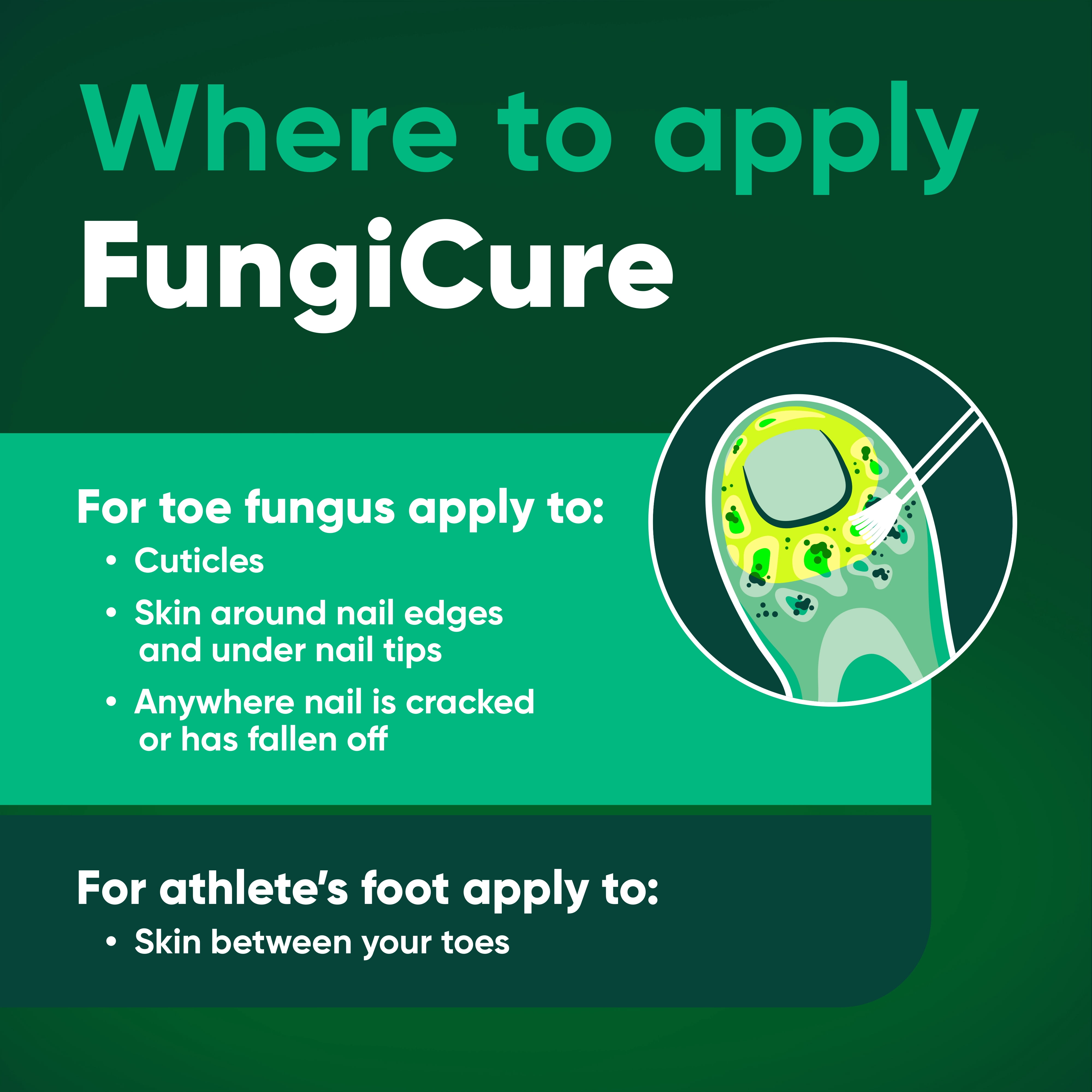 Fungicure Anti-Fungal Liquid - Nothing Stronger Without an RX - Clinically Proven - 1 fl oz