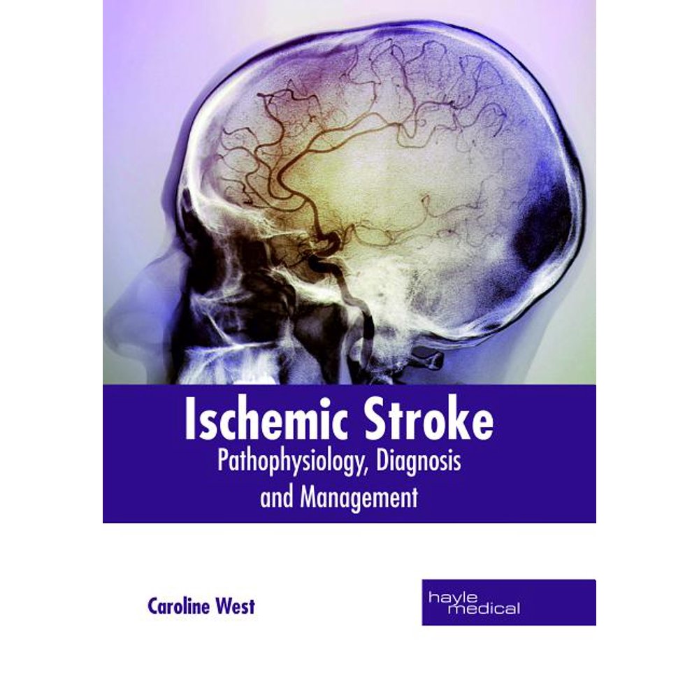 atypical presentation of ischemic stroke