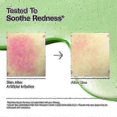 thumbnail image 4 of Anua Acid 10 Hyaluron Redness Soothing Serum Facial Spot Care 30ml 1oz - HF, 4 of 5