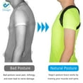thumbnail image 3 of Deago Posture Corrector for Men and Women Upper Back Brace Clavicle Support Device for Thoracic Kyphosis and Shoulder Neck Pain Relief (Size XL), 3 of 9