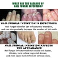 thumbnail image 3 of 30ml Nails Care Repair Nail Fungal Anti-Fungus Onychomycosis-Removal Liquid Ginger Foot Antifungal Nail Treatment Ginger Cuticle Care Oil, 3 of 5