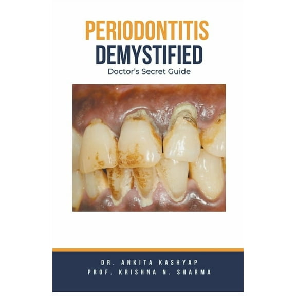 Periodontitis Demystified: Doctor's Secret Guide, (Paperback)