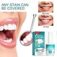thumbnail image 2 of Teeth Whitening Paint, Tooth Paint,teeth Whitening Gel Tooth Polish Uptight White Instant Whitening Paint, 2 of 5