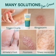 thumbnail image 3 of Crema antimicótica PHARMBANNER Clotrimazol 1% 60 g, 3 of 9