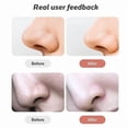 thumbnail image 2 of Limpiador facial eliminador de puntos negros HUOGUO Vacuum Suction, 2 of 5
