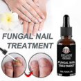 thumbnail image 2 of Advanced Nail Care Solution for Fungus Repair and Cuticle Health Treatment Oil, 2 of 4