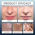 thumbnail image 2 of Fiudx Set de Cremas de Día y Noche, Crema Protectora de Día, Crema Reparadora y Renovadora de Noche, Fórmula de Hidratación Intensiva, Régimen de Nutrición de La Piel, Apto para Todo Tipo de Piel, Ca, 2 of 6