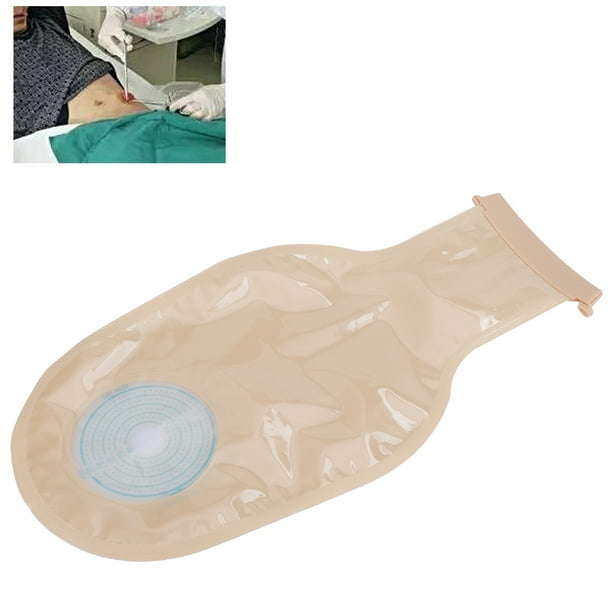 Mgaxyff Disposable Colostomy Pouch,Colostomy Bag,10pcs Disposable
