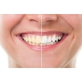 thumbnail image 2 of Blanqueador Dental Carbón Activado Idea Natural 100% Natural, 2 of 4