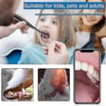 thumbnail image 4 of Usb Intraoral Dental Camera,led Light Visual Oral Mirror Endoscope Household Usb Mouth Oral Inspection Tool Dental Oral Mirror Dental Mirror, 4 of 5