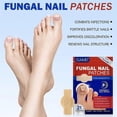 thumbnail image 3 of Fungal Nail Patches, Fungal Nail Treatment 21Pcs, Nails Repair Patches,Nails Fungus Treatment for Toenail,ToeNail Fungal Treatment for Toenails Extra, 3 of 5