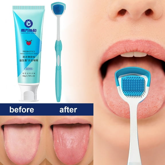 Kiplyki Tongue Cleansing Gel, Tongue Cleaner Brush Kit, Scraper, Fight Bad Breath, Oral Deodorant, Fresh Mint, Odor Eliminator