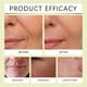 thumbnail image 3 of Facial Colágeno 4 Piezas Noche Profundo Antiarrugas para Hombres Y Mujeres, 3 of 9