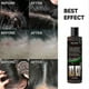 thumbnail image 3 of 1-3 uds Champú antipicazón Yuxing 100 ml Champú refrescante con aceite anticaída, 3 of 5