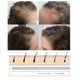 thumbnail image 5 of Ginger Hair Growth Spray Scalp Massage Moisturizes And Thickens Hair Care Nu, 5 of 5