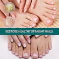thumbnail image 4 of Toenail Repair Liquid Nail Fungus Hand And Foot Nail Bump, 4 of 5