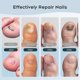 thumbnail image 5 of Nail Fungus Laser Treatment Device for Multiple Toenail, Home Use 905nm Infrared Light + 470nm Blue Light Toe Nail, 5 of 5