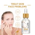 thumbnail image 2 of Tratamiento facial aceites esenciales,CAIXIN suero de piel de arroz blanco 20ml para mujeres iluminadas, 2 of 6