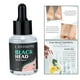 thumbnail image 5 of Suero para Eliminar Puntos Negros de 30 Ml, Control de Aceite para Limpieza Profunda de , atención de, 5 of 9