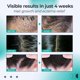 thumbnail image 3 of EELHOE scalp care roller cleaning scalp itching relieving itching refreshing moisturizing skin anti-dr, 3 of 4