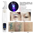 thumbnail image 2 of Lápiz láser de picosegundos portátil, máquina para eliminar cicatrices de tatuajes y pecas, dispositivo de belleza para la piel, 2 of 10