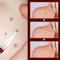 thumbnail image 2 of Uso fácil del extracto natural de la crema del retiro del defecto 3ml para el tratamiento Yeso médico Ehuebsd Cuidado Belleza, 2 of 6