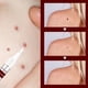 thumbnail image 2 of Eliminación de 3 ml Crema para manchas Extracto natural Uso fácil para yeso médico Ndcxsfigh Cuidado Belleza, 2 of 6