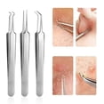 thumbnail image 1 of 3 piece blackhead removal clip8.7cm, stainless steel beveled acne clip, cotton tweezers, beauty acne needle, easily remove tiny acne, remove acne blac, 1 of 4