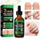 thumbnail image 3 of Toenail Fungus Nail Treatment Extra Strength Ginger Nail Treatmant Nail Support Nail Care, Nail Treatmant, Nail Strengthener Ginger Nail Growth Serum, 3 of 5