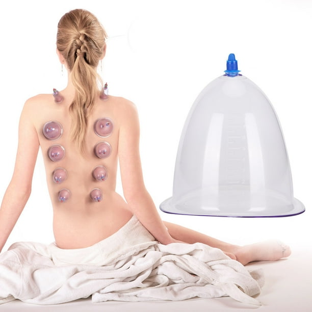 Espalda Ventosaterapia Precio Tratamiento De Ventosas En La