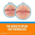 thumbnail image 2 of Bálsamo labial O'Keeffe's Cooling Relief Lip Repair Stick, paquete de 3, 2 of 5